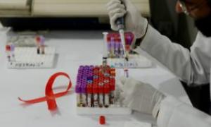 इसका क्या मतलब है: आपने एचआईवी के प्रति एंटीबॉडी का पता लगाया है (पता नहीं लगाया है)।